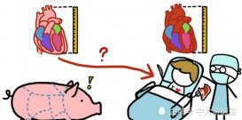 猪肾可以移植人体吗?世界首例猪肾脏移植人体手术成功